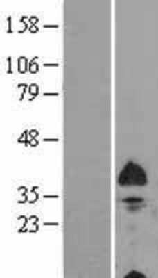 Western Blot: BNIP3L Overexpression Lysate [NBL1-08015]