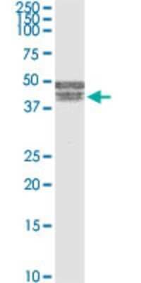 Western Blot: BNIPL Antibody (2C8) [H00149428-M03]