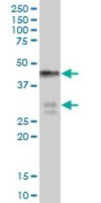 Western Blot: BNIPL Antibody [H00149428-B01P]