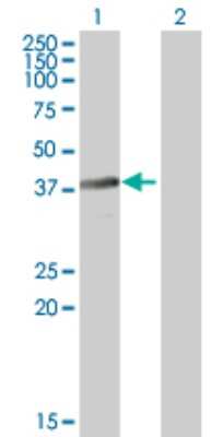 Western Blot: BNIPL Antibody [H00149428-B01P]