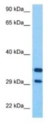 Western Blot: BNIPL Antibody [NBP3-10618]