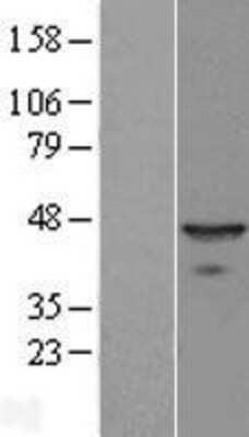 Western Blot: BNIPL Overexpression Lysate [NBL1-08016]