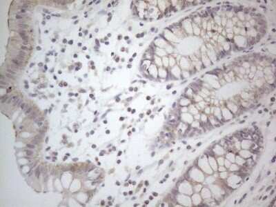 Immunohistochemistry: NT-proBNP Antibody (OTI11G4) [NBP2-46201]