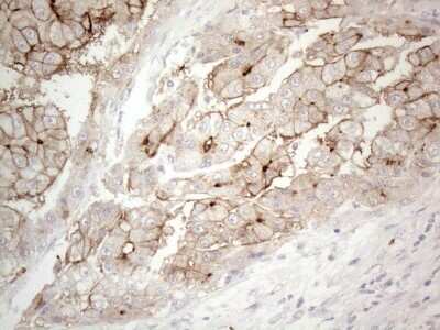 Immunohistochemistry: NT-proBNP Antibody (OTI11G4) [NBP2-46201]