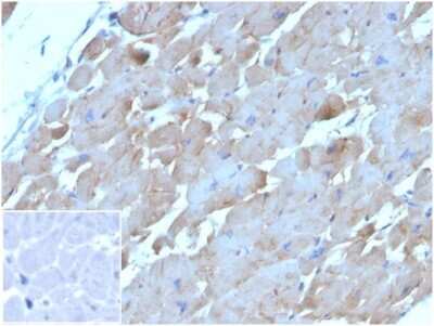 Immunohistochemistry-Paraffin: BNP Antibody (NPPB/4493) [NBP3-13984]