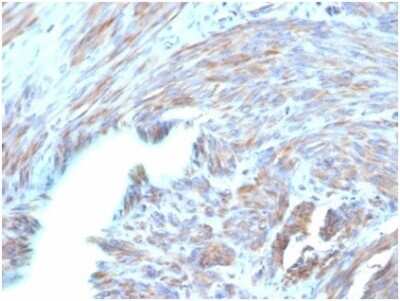 Immunohistochemistry-Paraffin: BNP Antibody (NPPB/4493) [NBP3-13984]