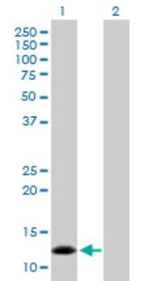 Western Blot: BNP Antibody [H00004879-D01P]