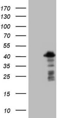 Western Blot: BOB1 Antibody (OTI1E11) [NBP2-45373]