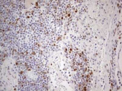 Immunohistochemistry: BOB1 Antibody (OTI2D4) [NBP2-45374]