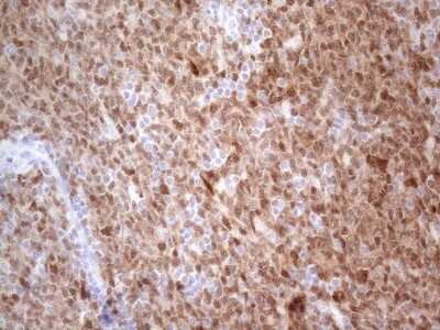 Immunohistochemistry: BOB1 Antibody (OTI2D4) [NBP2-45374]