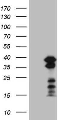 Western Blot: BOB1 Antibody (OTI2D4) [NBP2-45374]