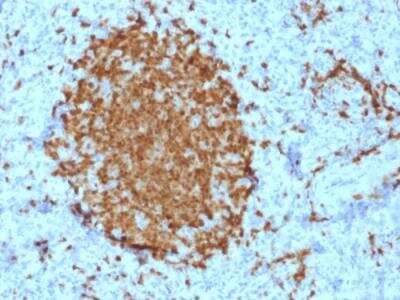 Immunohistochemistry-Paraffin: BOB1 Antibody (BOB1/2421) - Azide and BSA Free [NBP2-79885]