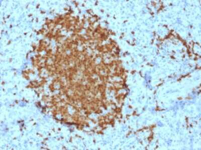 Immunohistochemistry-Paraffin: BOB1 Antibody (BOB1/2421) [NBP2-79750]