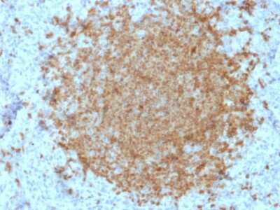 Immunohistochemistry-Paraffin: BOB1 Antibody (BOB1/2422) [NBP3-07635]