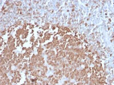 Immunohistochemistry-Paraffin: BOB1 Antibody (BOB1/2422) [NBP3-07635]