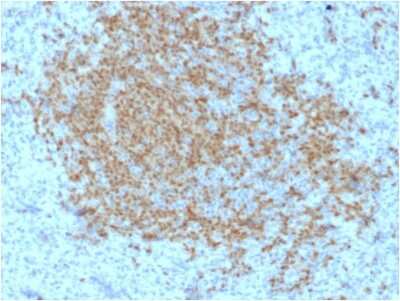 Immunohistochemistry-Paraffin: BOB1 Antibody (BOB1/2423) [NBP3-07642]