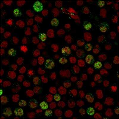Immunocytochemistry/ Immunofluorescence: BOB1 Antibody (BOB1/2424) - Azide and BSA Free [NBP2-75753]