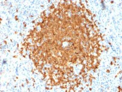 Immunohistochemistry-Paraffin: BOB1 Antibody (BOB1/2424) [NBP2-75752]