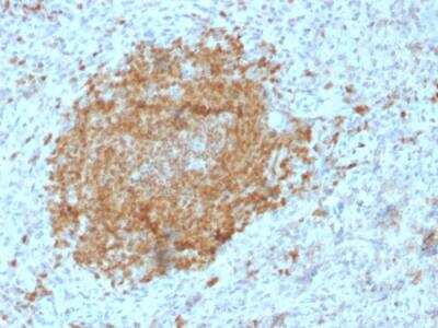 Immunohistochemistry-Paraffin: BOB1 Antibody (BOB1/2425) - Azide and BSA Free [NBP2-75757]