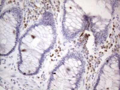 Immunohistochemistry: BOB1 Antibody (OTI2D4) - Azide and BSA Free [NBP2-71224]