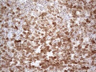 Immunohistochemistry: BOB1 Antibody (OTI2D4) - Azide and BSA Free [NBP2-71224]