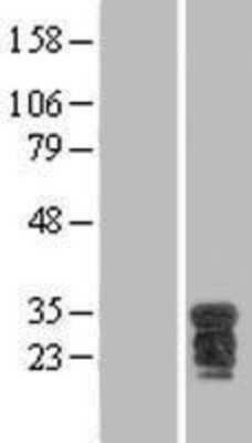 Western Blot: BOB1 Overexpression Lysate [NBL1-14616]