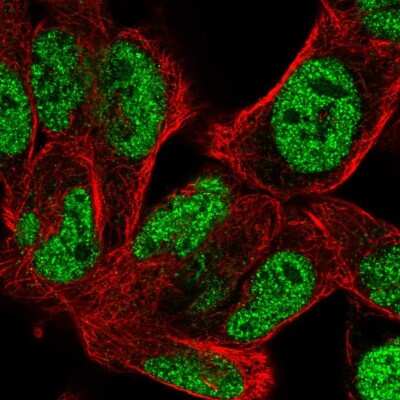 Immunocytochemistry/ Immunofluorescence: BOC Antibody [NBP2-56289]