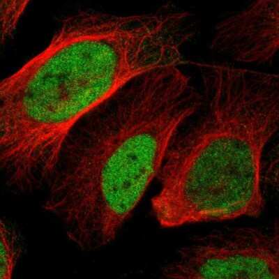 Immunocytochemistry/ Immunofluorescence: BOC Antibody [NBP2-57618]