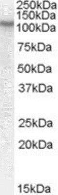 Western Blot: BOC Antibody [NBP1-00162]