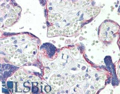 Immunohistochemistry-Paraffin: BOD1 Antibody [NBP1-52150]