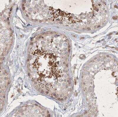 Immunohistochemistry-Paraffin: BOD1 Antibody [NBP1-83927]