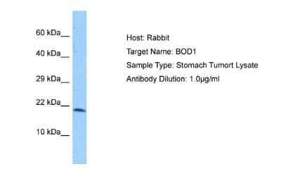 Western Blot: BOD1 Antibody [NBP2-84507]