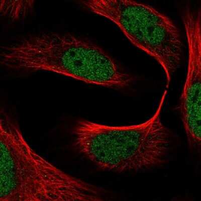 Immunocytochemistry/ Immunofluorescence: BOD1L Antibody [NBP2-34069]