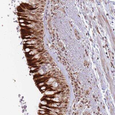 Immunohistochemistry: BOD1L Antibody [NBP2-34036]