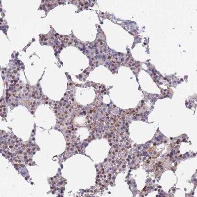 Immunohistochemistry: BOD1L Antibody [NBP2-34069]