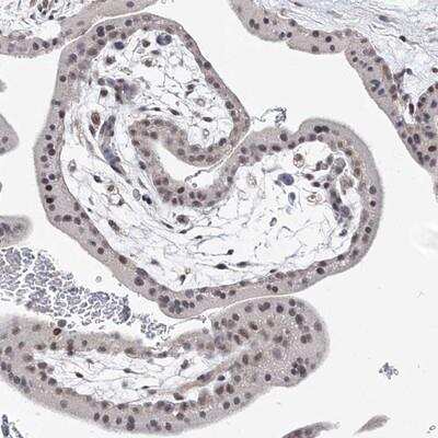 Immunohistochemistry-Paraffin: BOD1L Antibody [NBP1-83928]