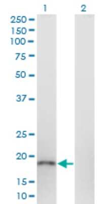 Western Blot: BOD1P Antibody (1C9) [H00284257-M01]