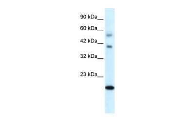 Western Blot: BOLA1 Antibody [NBP2-84508]