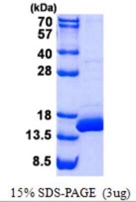 SDS-PAGE: Recombinant Human BOLA1 His Protein [NBP2-22714]