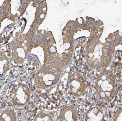 Immunohistochemistry-Paraffin: BOLA2 Antibody [NBP2-54720]