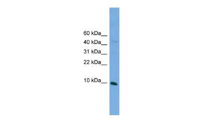 Western Blot: BOLA2 Antibody [NBP3-10445]