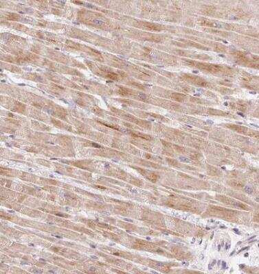 Immunohistochemistry-Paraffin: BOLA3 Antibody [NBP2-30607]