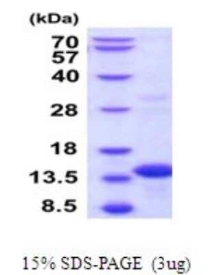 SDS-PAGE: Recombinant Human BOLA3 His Protein [NBP2-52111]