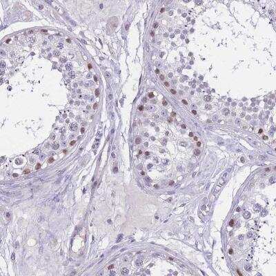 Immunohistochemistry-Paraffin: BOP1 Antibody [NBP2-33504]