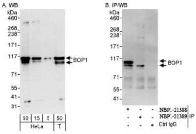 Immunoprecipitation: BOP1 Antibody [NBP1-21389]