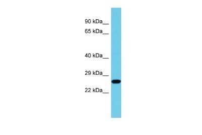 Western Blot: BORC6 Antibody [NBP2-84510]