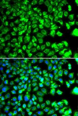 Immunocytochemistry/ Immunofluorescence: BORCS7 Antibody - BSA Free [NBP3-03231]