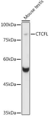 Western Blot: BORIS AntibodyAzide and BSA Free [NBP2-92659]