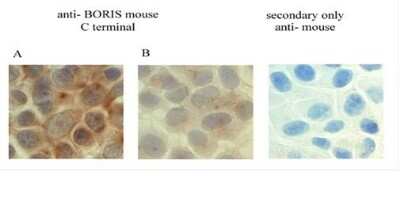 Immunohistochemistry: BORIS Antibody (20B11) - BSA Free [NBP2-52405]