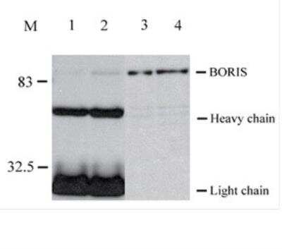Immunoprecipitation: BORIS Antibody (20B11) - BSA Free [NBP2-52405]